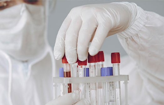 جليلة بن خليل: جميع المؤشرات الوبائية في تونس تدل على بوادر موجة خامسة لكورونا